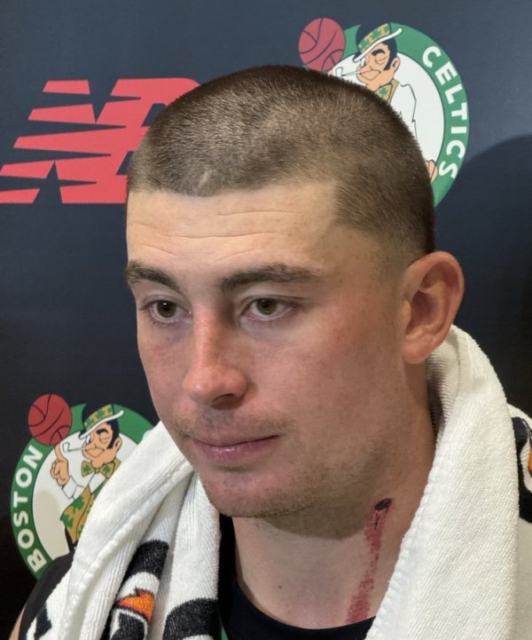 颈部有明显血痕！普理查德：练习  营里的对峙  像打仗一样